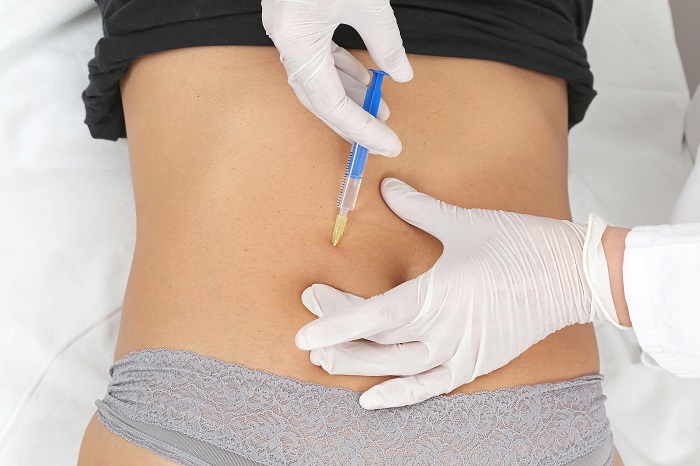 Comparison Liposuction vs Fat Dissolving Injections in Pakistan