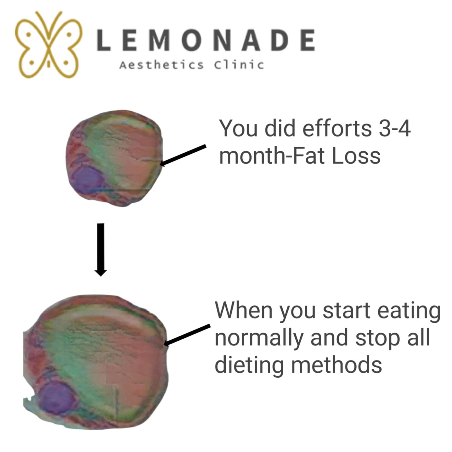 Stomach Injections for Weight Loss in Lahore